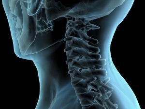μέθοδοι για τη διάγνωση της οστεοχόνδρωσης του λαιμού